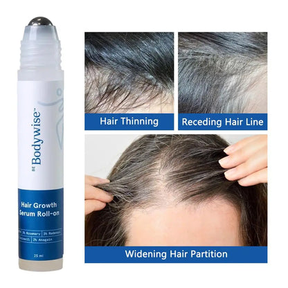Rosemary Hair Nourishing Serum – Roll-On for Healthy Scalp & Growth