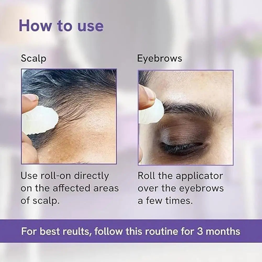 Rosemary Hair Nourishing Serum – Roll-On for Healthy Scalp & Growth
