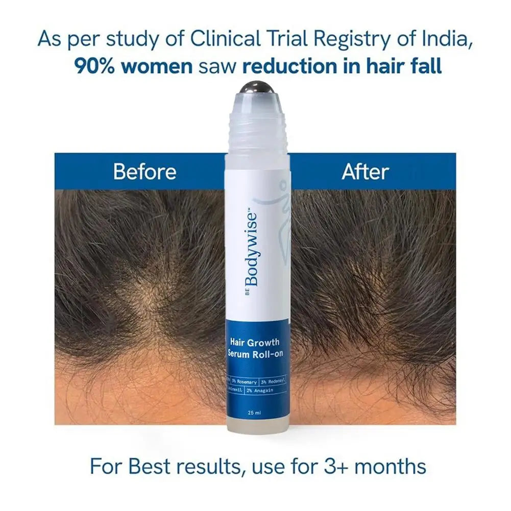 Rosemary Hair Nourishing Serum – Roll-On for Healthy Scalp & Growth