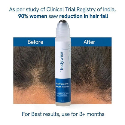 Rosemary Hair Nourishing Serum – Roll-On for Healthy Scalp & Growth